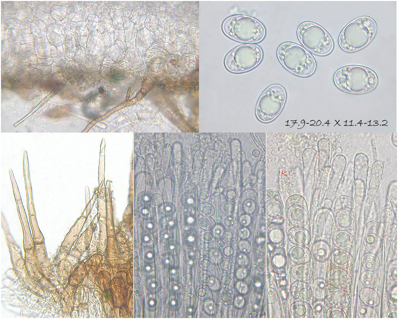 Trichophaea woolhopeia photo 4