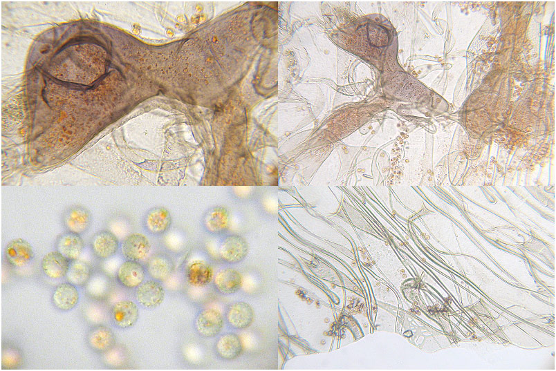 Lycogala conicum photo 7